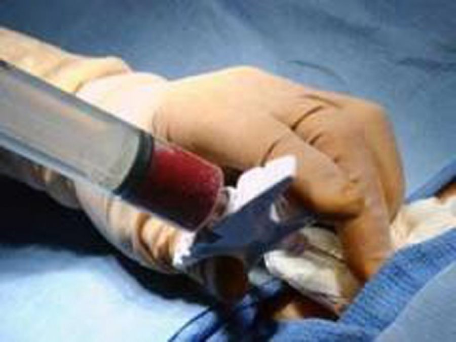 Kan Bankacılığı ve Transfüzyon Tıbbi Eğitimi başvuruları bugün sona eriyor 
